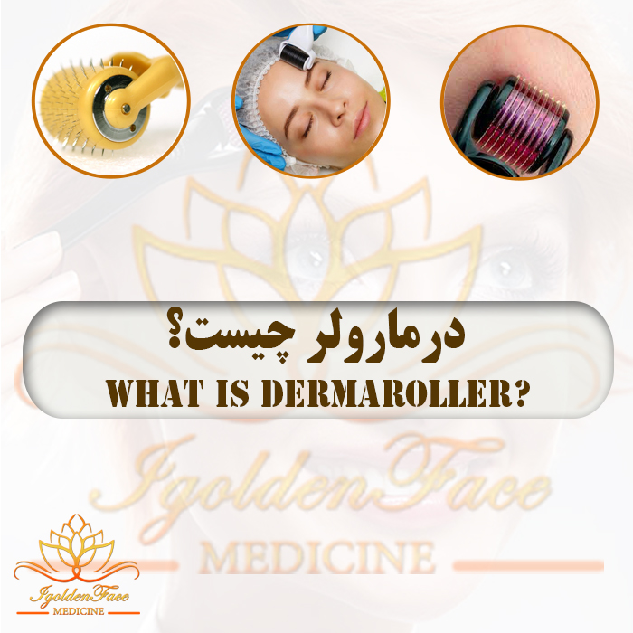 درمارولر چیست؟ What is Dermaroller?