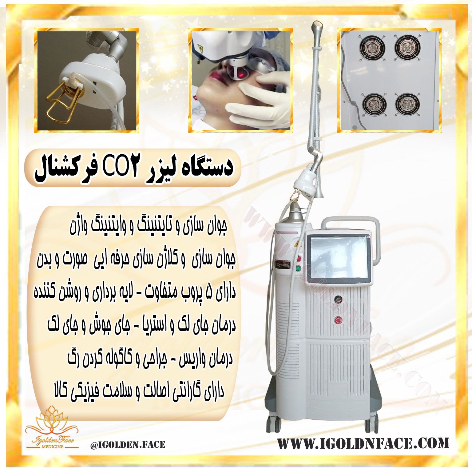 لیزر فوتونا
