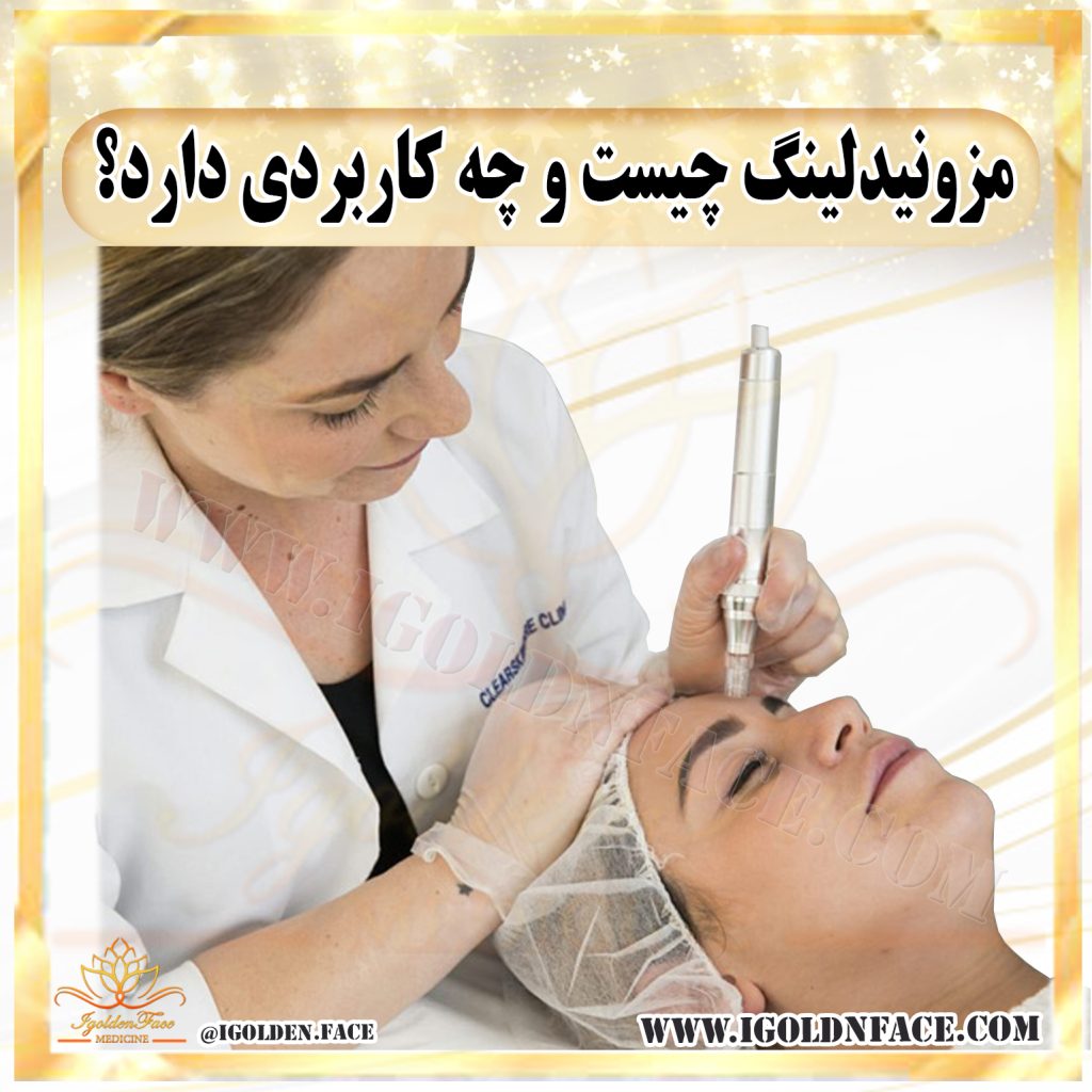 مزونیدلینگ چیست و چه کاربردی دارد؟