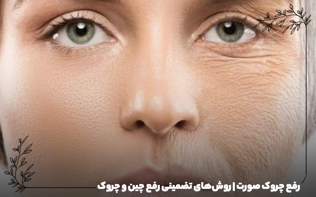 رفع چروک صورت | روش‌های تضمینی رفع چین و چروک صورت!