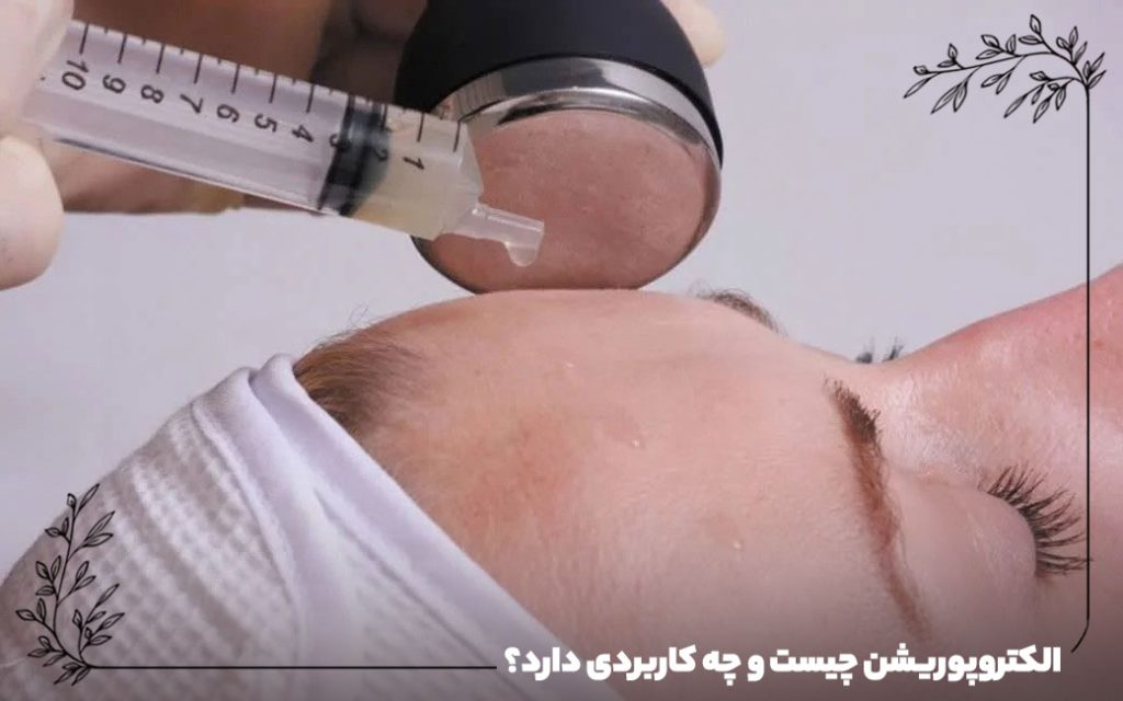 الکتروپوریشن چیست و چه کاربردی دارد؟