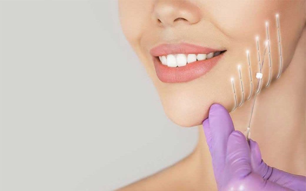نخ کلاژن ساز جذبی چیست