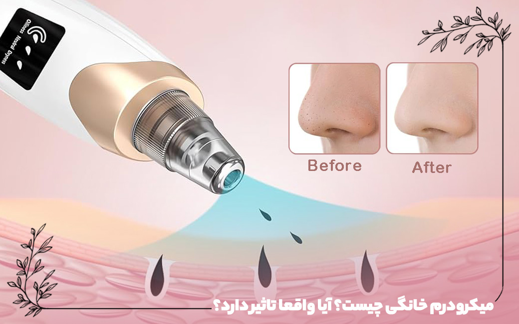 دستگاه میکرودرم خانگی چیست؟